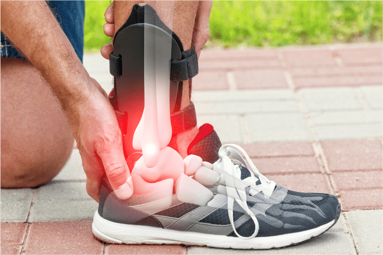 Arthroscopic surgery recovery