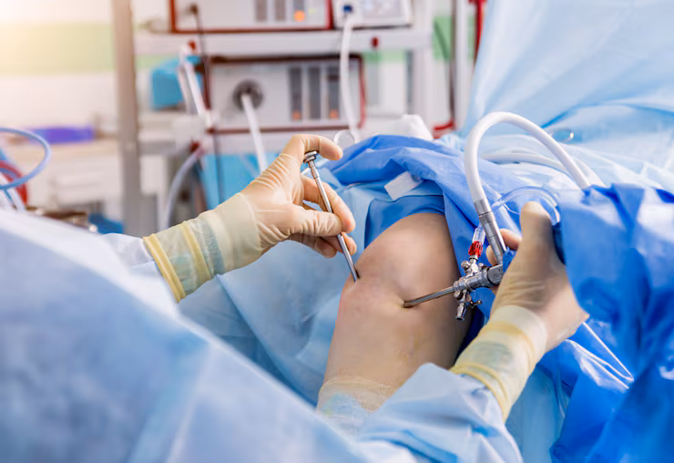Keyhole (Arthroscopic) Surgery treatment at Dr. G.K's Advanced Bone and Joint Centre